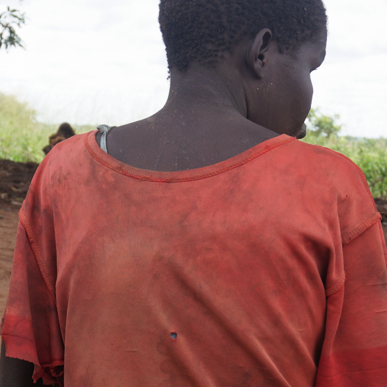 01_GPJNews_Uganda_PL_NoddingSyndrome_028_L copy