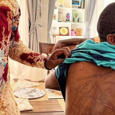 Courtesy picture of Robert Kyagulanyi Ssentamu observing torture marks on novilist Kakwenza-Rukirabashaija’s back.